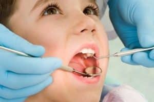 Karijes mlečnih zuba opasan: saveti koje će vam dati svaki dečiji stomatolog