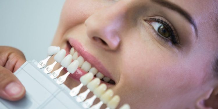 Implanti za zube