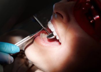 Želite blistav osmeh? Evo šta stomatolozi prvo proveravaju