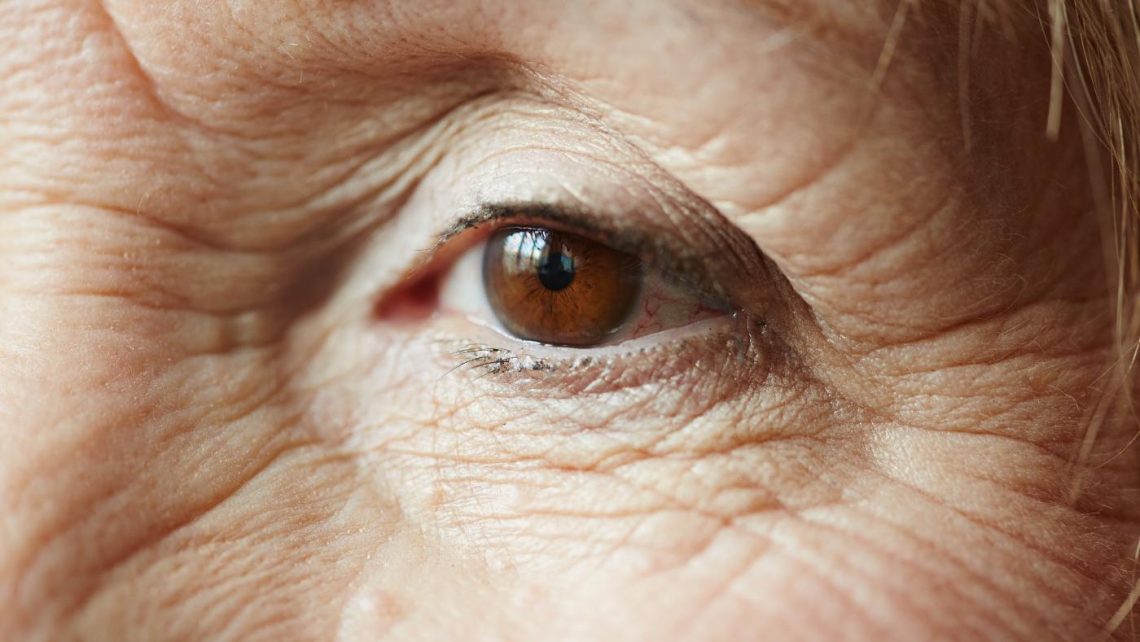 Starija žena bore oko očiju